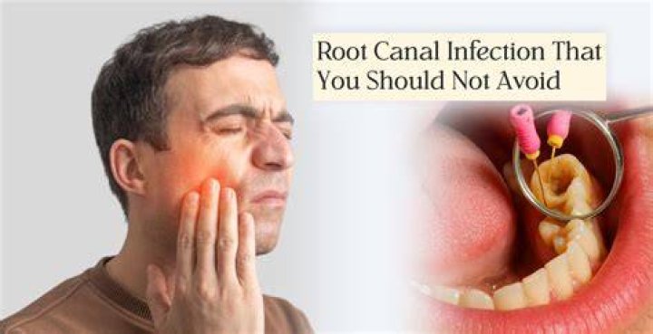 Can a root canal be done if there is an infection?