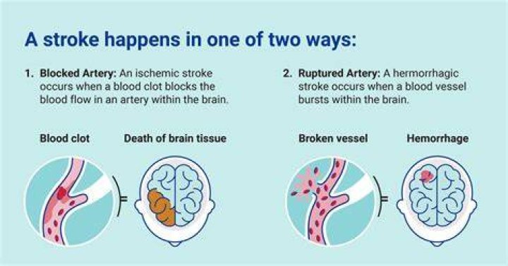 Can a stroke cause erratic behavior?