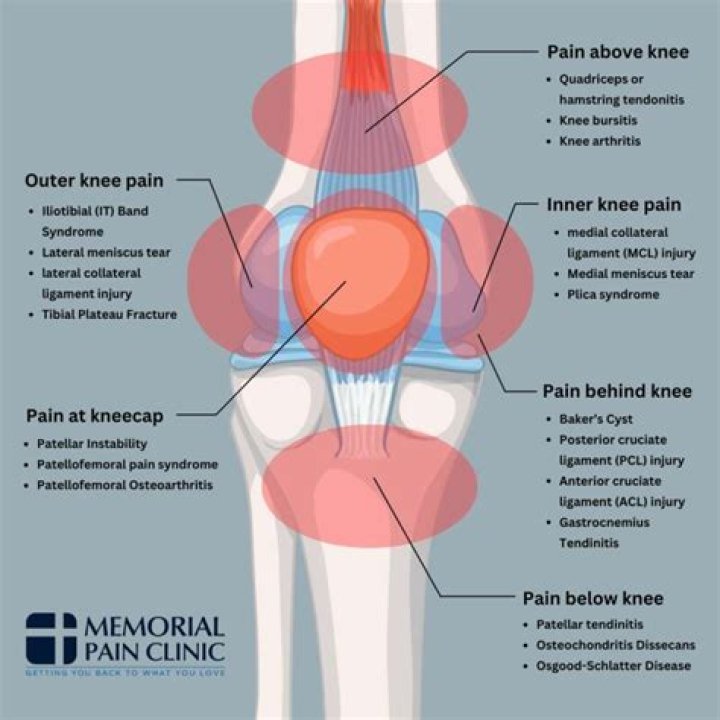 Can foot and knee pain be related?