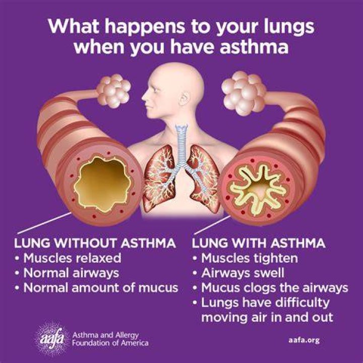 Can homeopathy medicine cure asthma?