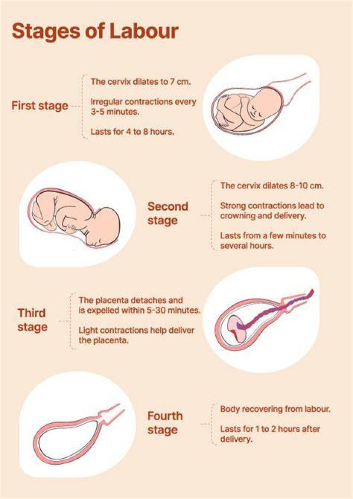 Can I go into labor without a bloody show?