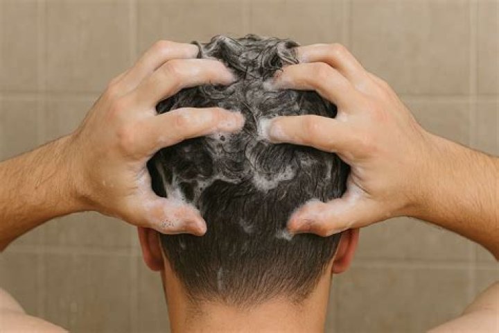 Can Nizoral shampoo help with hair loss?