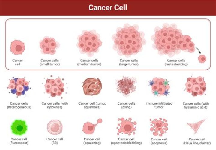 Can sweat glands be cancerous?