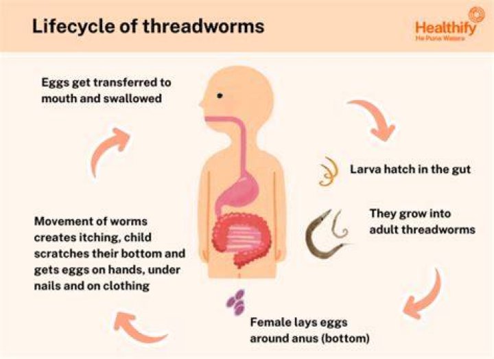 Can Threadworms cause vertigo?