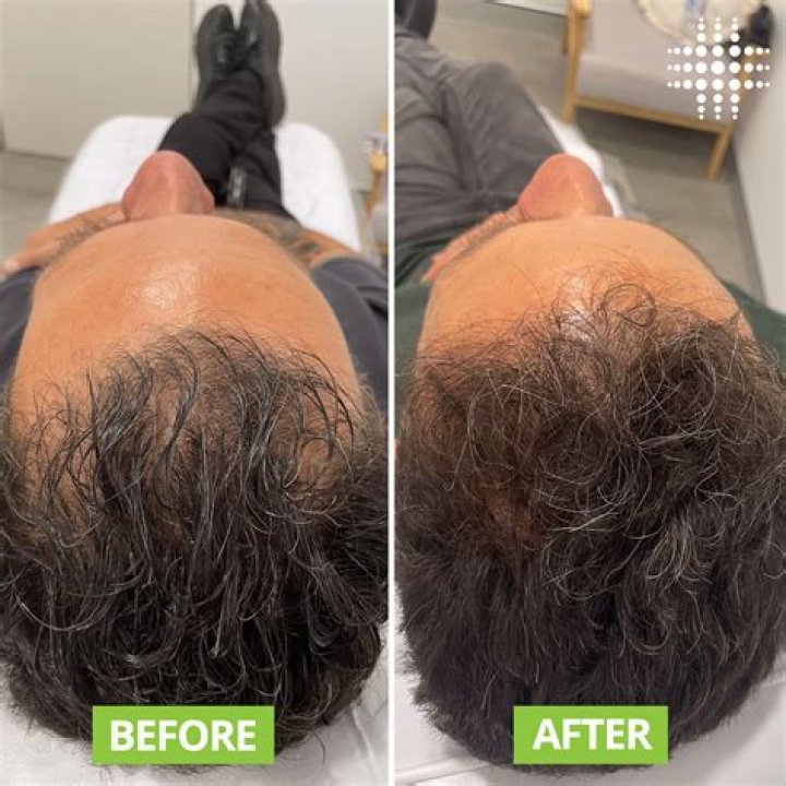 Can you regrow edges?