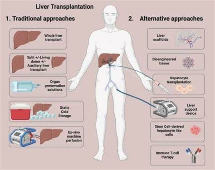 Do transplant patients take on characteristics of the donor?