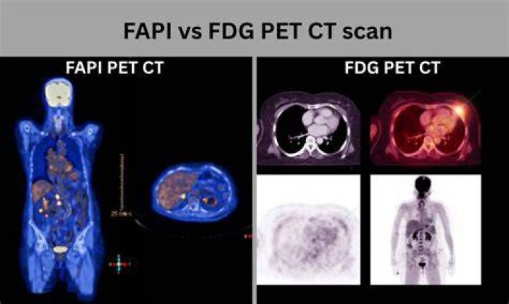 Do you feel bad after a PET scan?