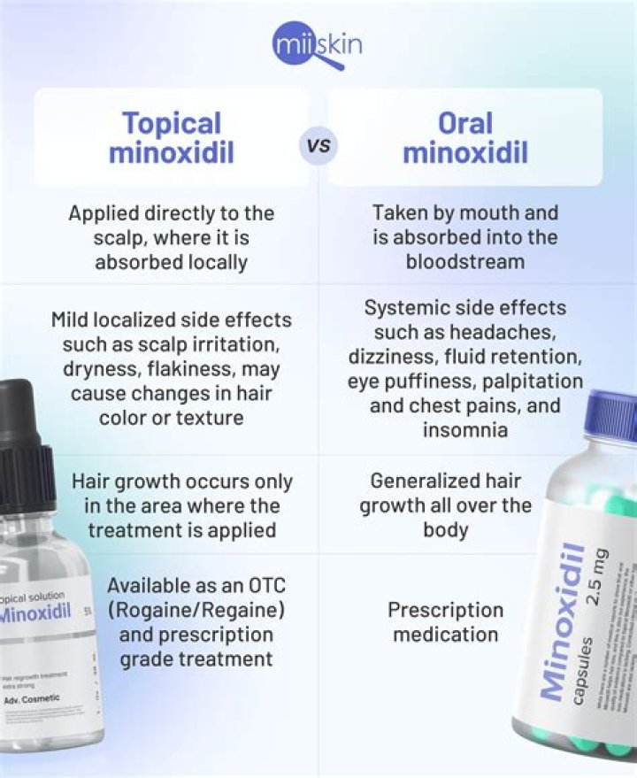 Does aminexil really work?