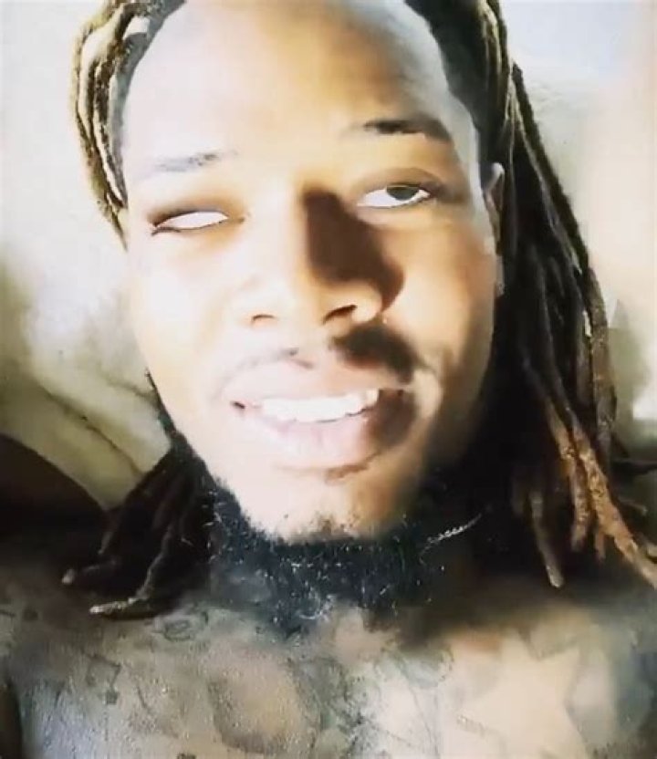 Does Fetty Wap have a prosthetic eye?