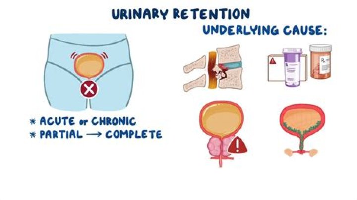 Does lupus cause urinary retention?