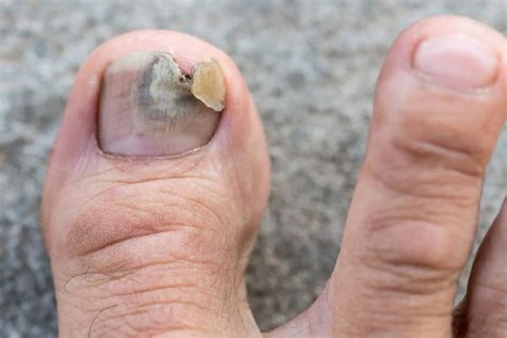 How do I cure Omluag in Skyrim?