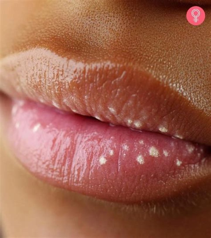 How do I get rid of a red spot on my lip?