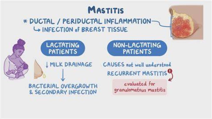 How do I know if I have mastitis abscess?