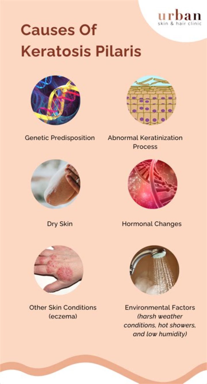 How do I stop itching from keratosis pilaris?