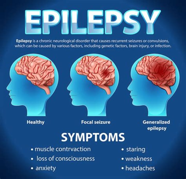 How does heroin affect epilepsy?