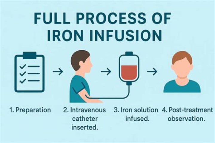 How is iron infusion calculated?