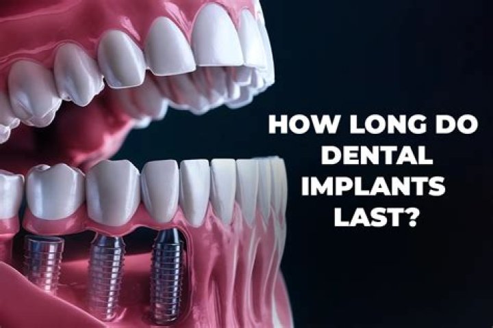 How long do PIP implants last?