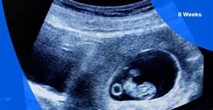 Is 8 weeks a fetus or embryo?