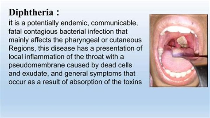 Is diphtheria a non communicable disease?