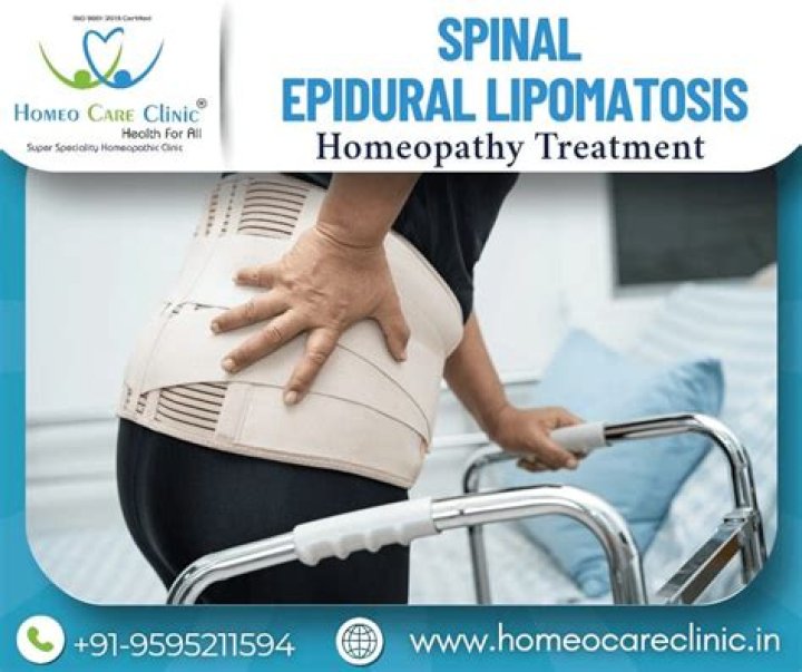 Is epidural lipomatosis rare?