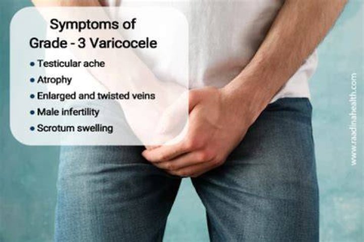 Is grade 3 varicocele bad?