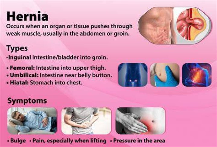 Is it common to get a hernia after pregnancy?
