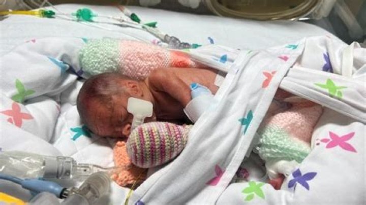 Is it normal for a baby to be sick after every feed?