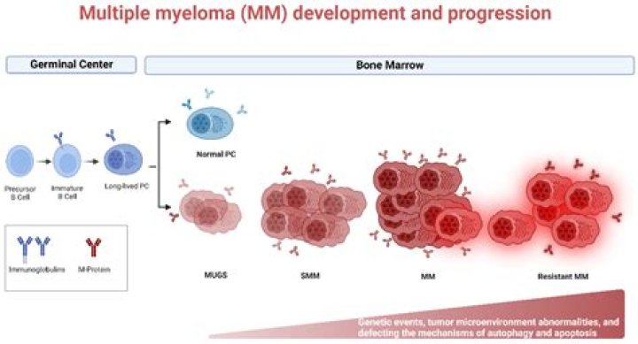 Is multiple myeloma a terminal?