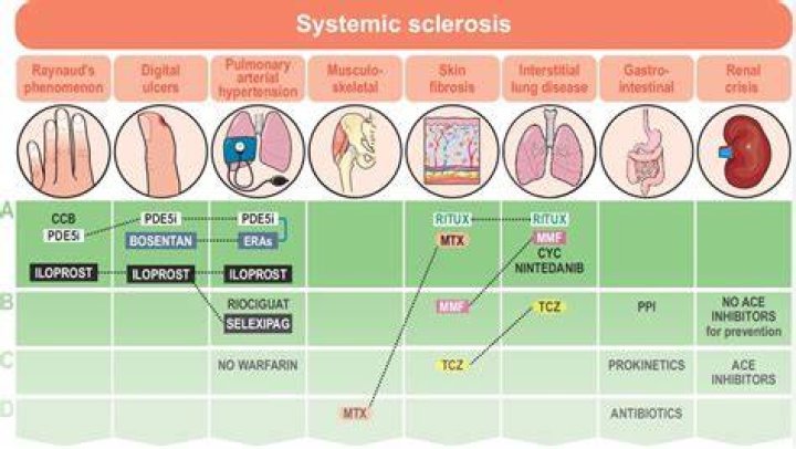 Is systemic sclerosis hereditary?