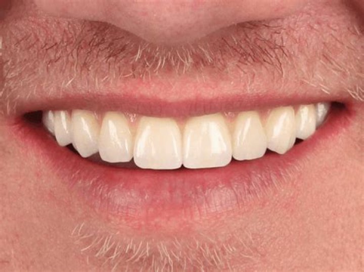 Is tooth regeneration possible?