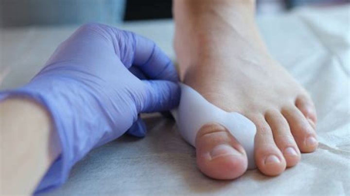 What anesthesia is used for Bunionectomy?