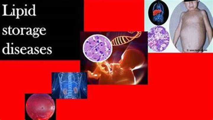 What are lipid storage diseases?
