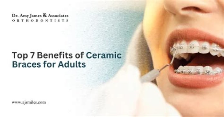 What are the advantages of ceramic braces?