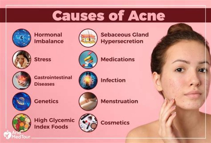 What are the causes of exudates?