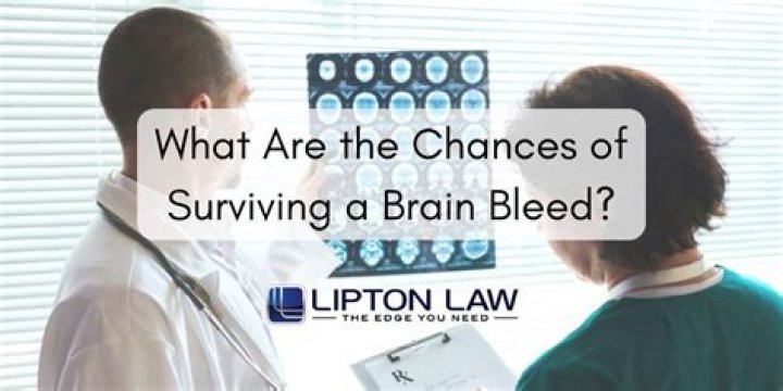 What are the chances of surviving a brain bleed?