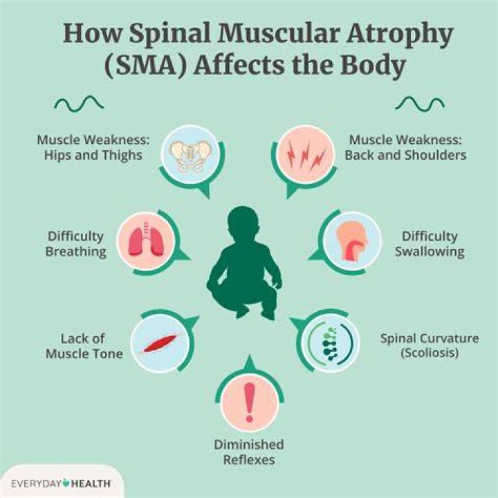 What are the signs and symptoms of congenital muscular dystrophy?