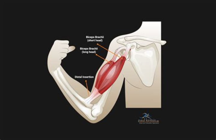 What are the symptoms of a torn ligament in the arm?