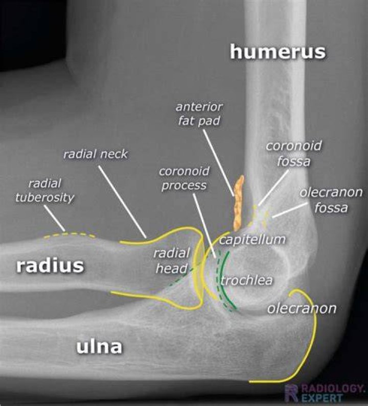 What are the three common radiographic views of the elbow?
