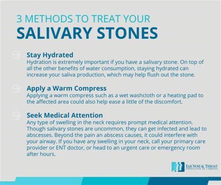 What causes salivary stones?