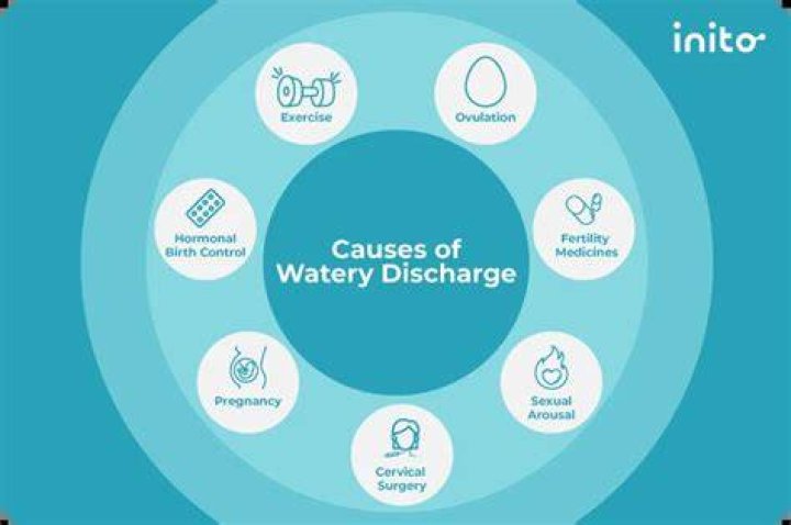 What causes white watery discharge?