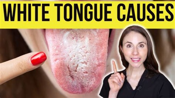 What causes your tongue to turn red?