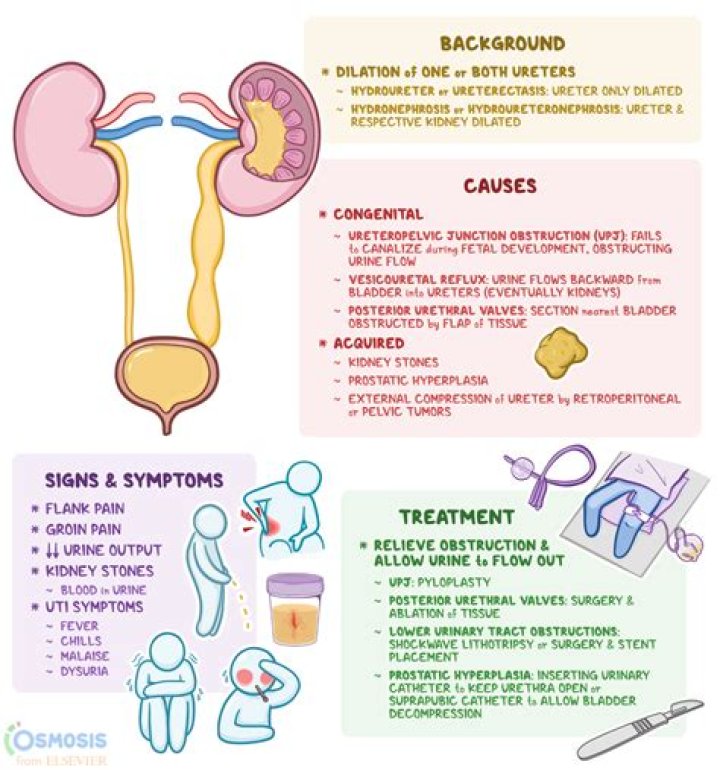 What condition is associated with urinary stasis?