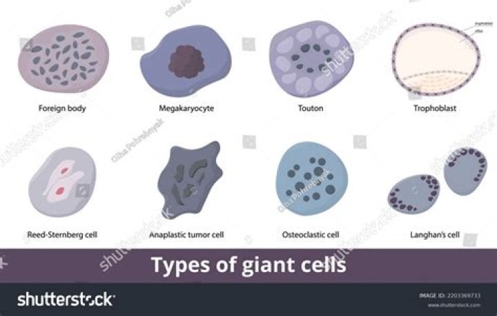 What do giant cells indicate?