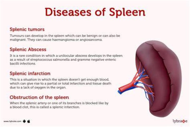 What do nodules on the spleen mean?