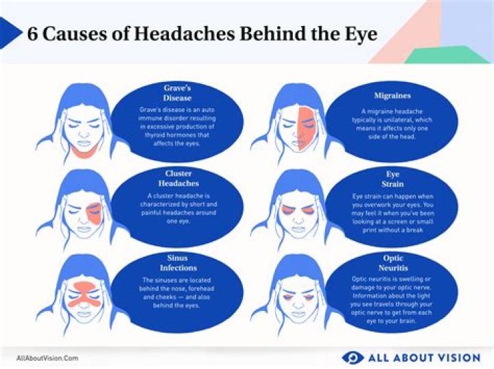 What does a dry eye headache feel like?