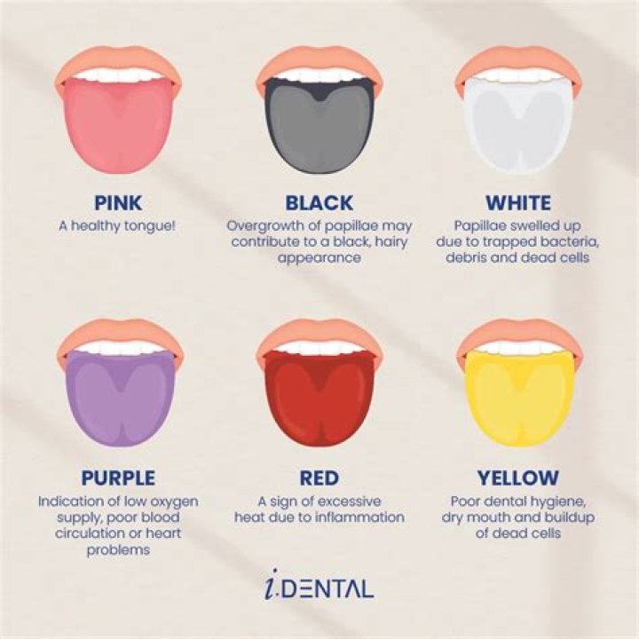 What does it mean when your smelling blood?