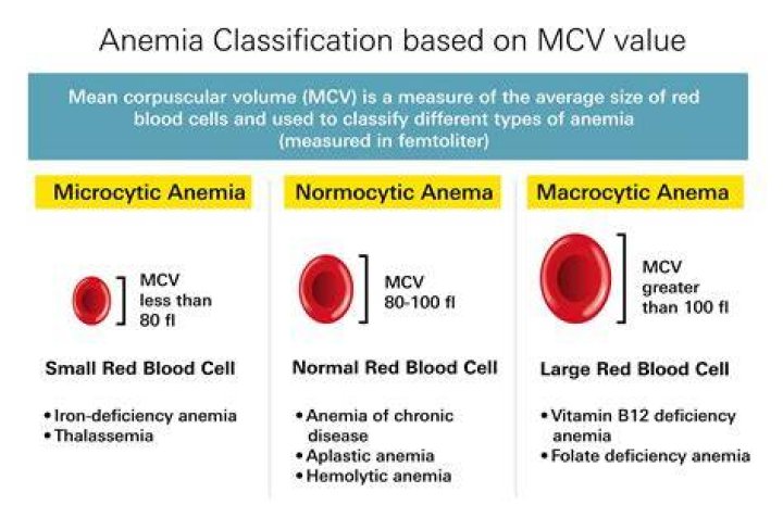 What does MCV stand for in Virginia?