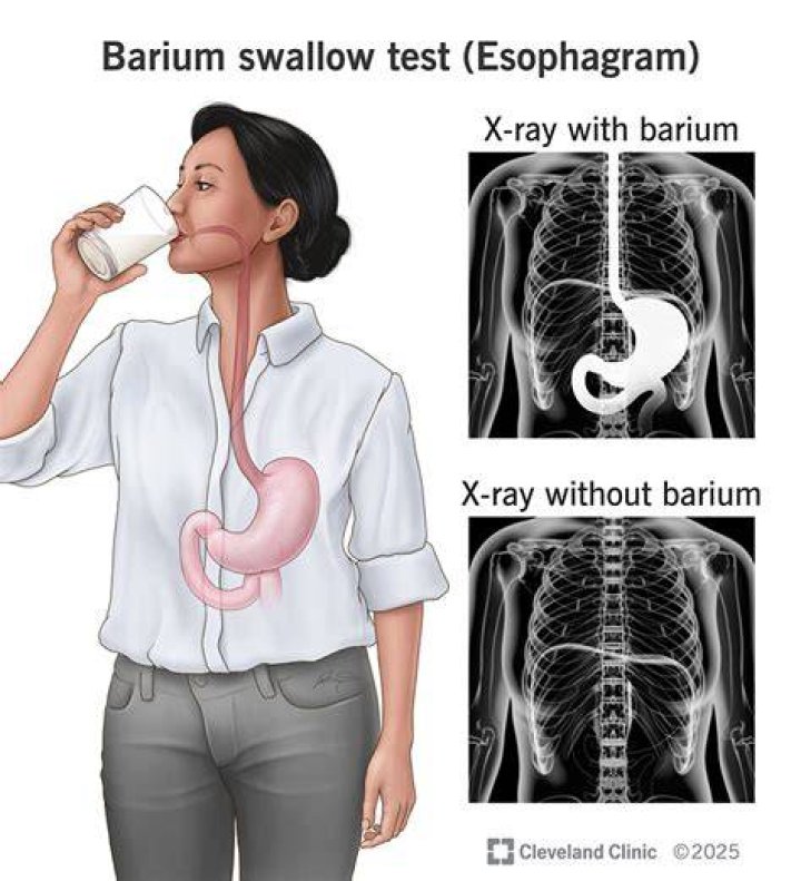 What happens during an Esophagram?