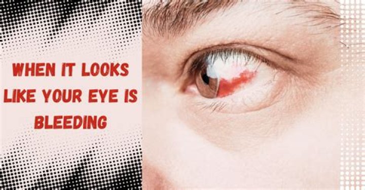 What happens to your eyes when your lying?
