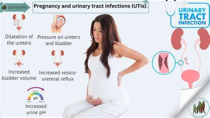 What helps UTI pain while pregnant?